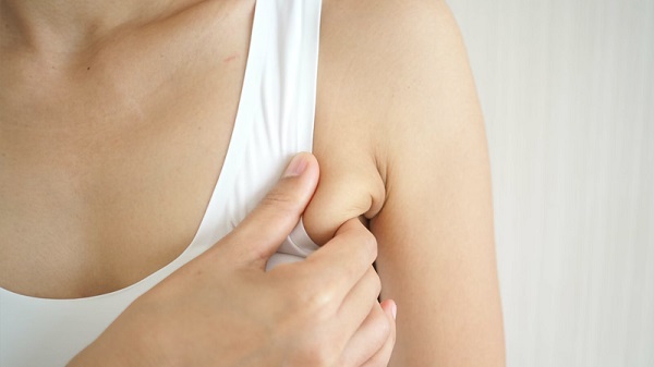 Nguyên nhân tích tụ mỡ vùng bắp tay và nách