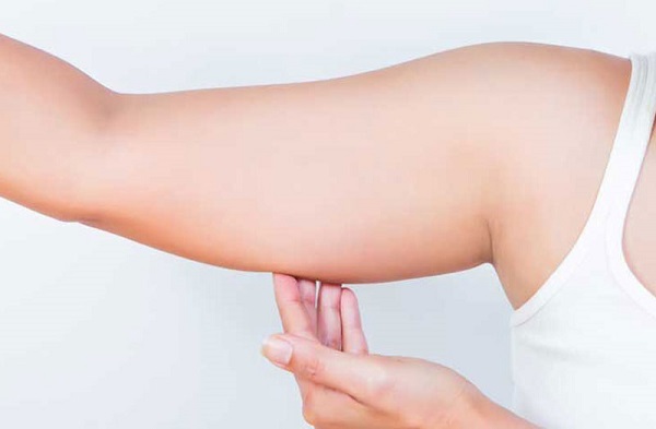 Nguyên nhân gây tích tụ mỡ bắp tay