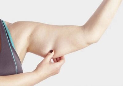 Cấu tạo và đặc điểm của mỡ bắp tay